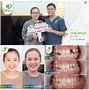 Trồng Răng Implant Bao Nhiêu Tiền